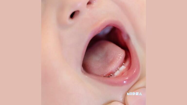 dientes de leche
