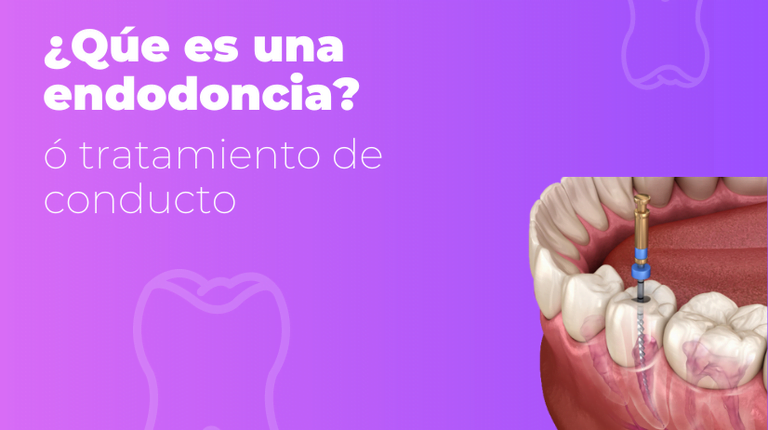 ENDODONCIA