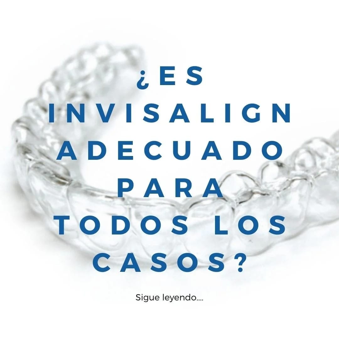 ¿es invisalign adecuado para todos los casos? ¿es invisalign adecuado para todos los casos?