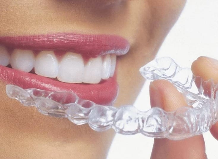 invisible orthodontics