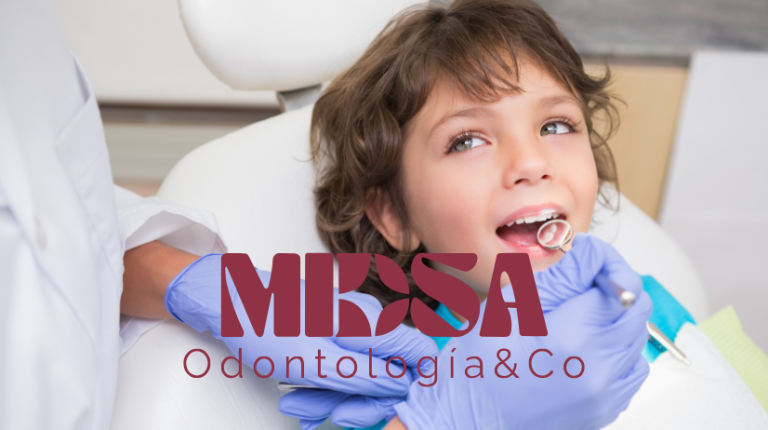 Selladores dentales en niños: qué son y por qué pueden evitar la caries